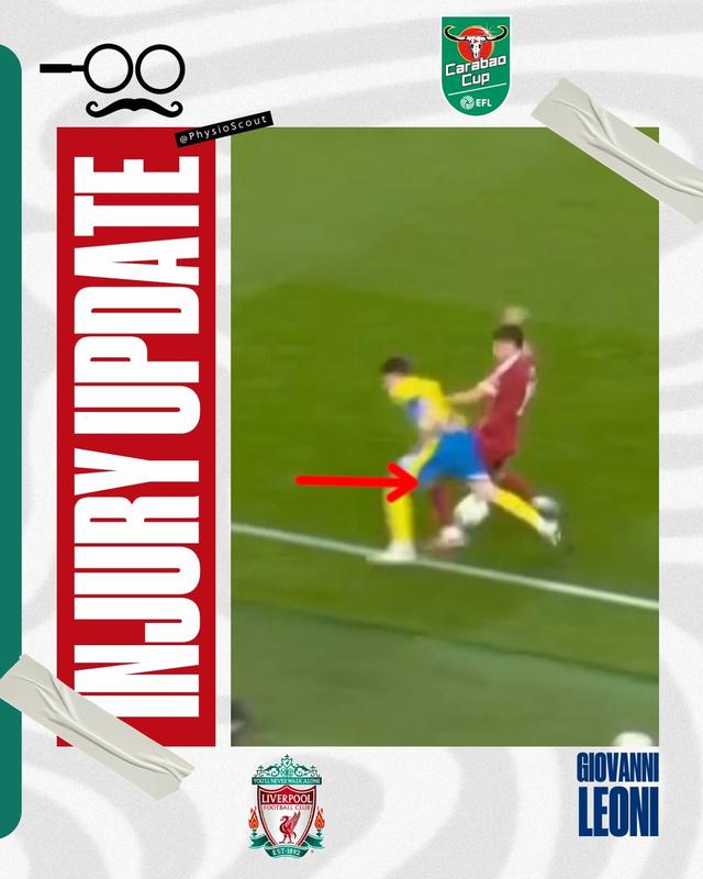 Physi, 带是否断裂, 由于视频资 Physi, 带是否断裂, 由于视频资